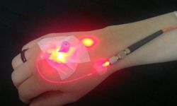 Tek Bacak ve Ele Dikkat: Lenfödem Uyarısı